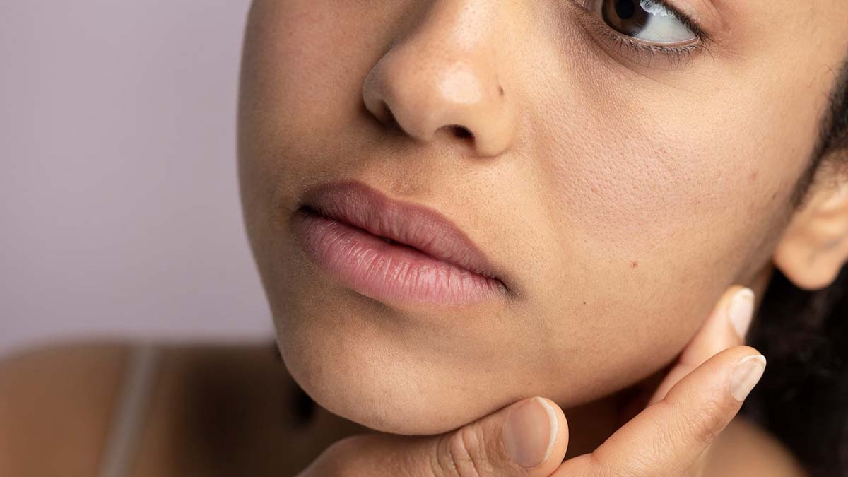 Face Pimple Se Chutkara Kaise Paye