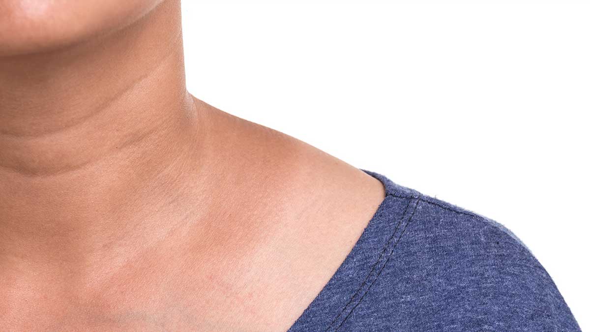 dark neck and tanning home remedies