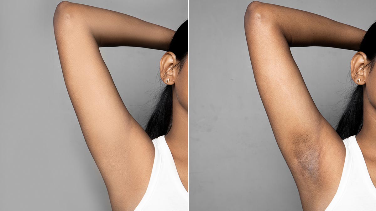 different tips to make underarms lighter