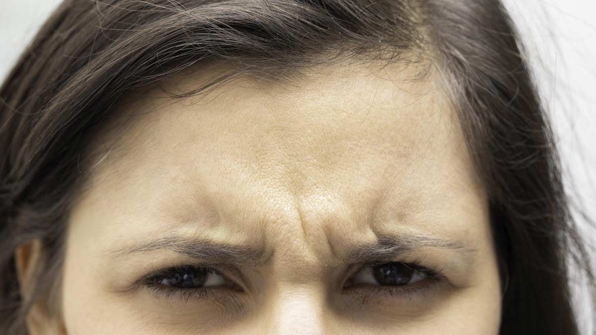 eye and forehead sagging