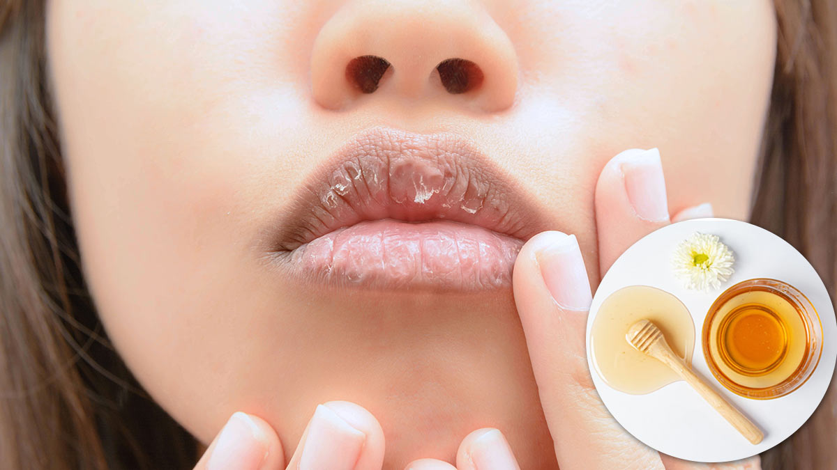 home remedies for dry lips in hindi
