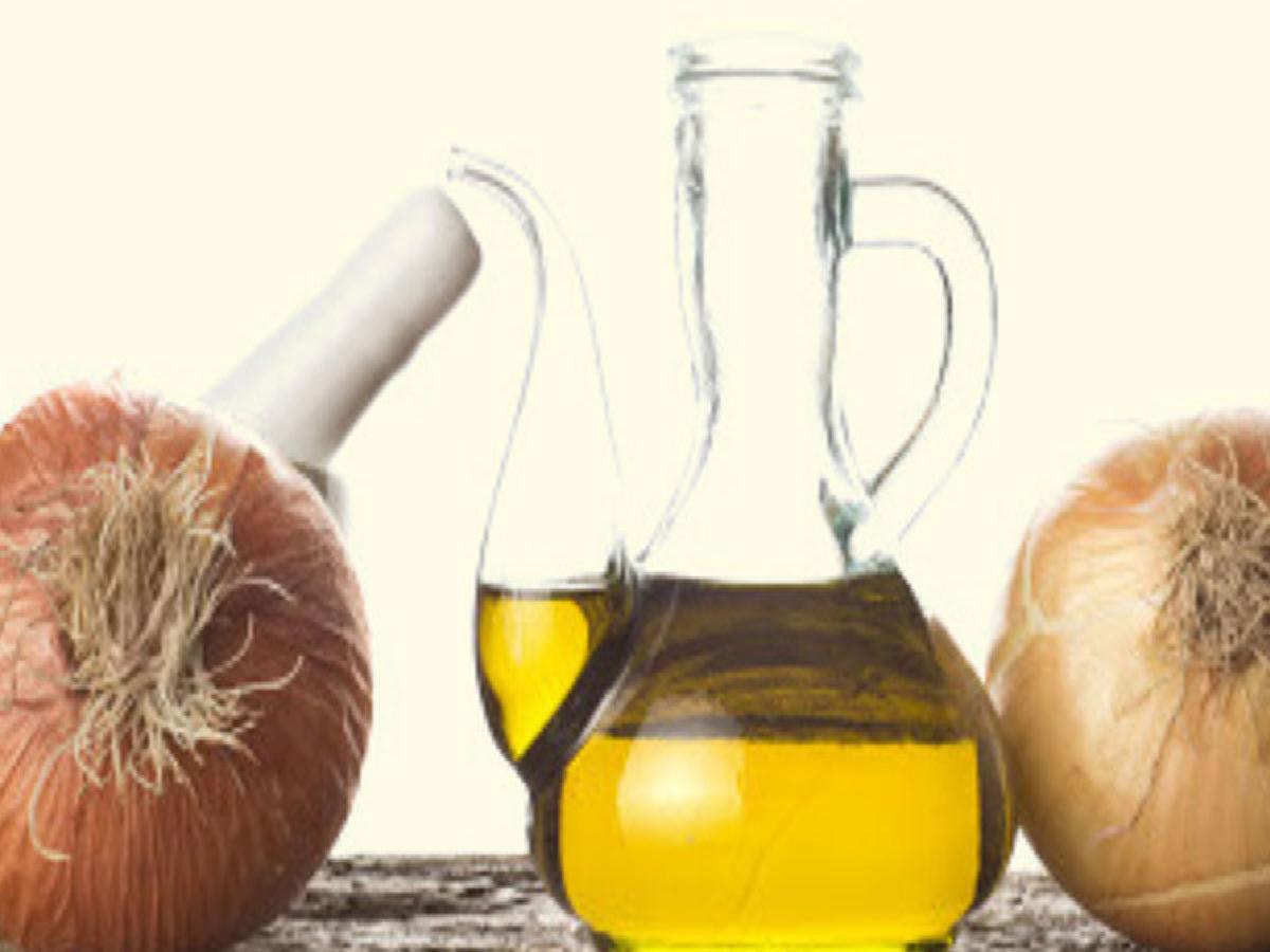 Suffering From Hair Issues Like Thinning And Dryness? Start Using This  Homemade Onion Oil | HerZindagi