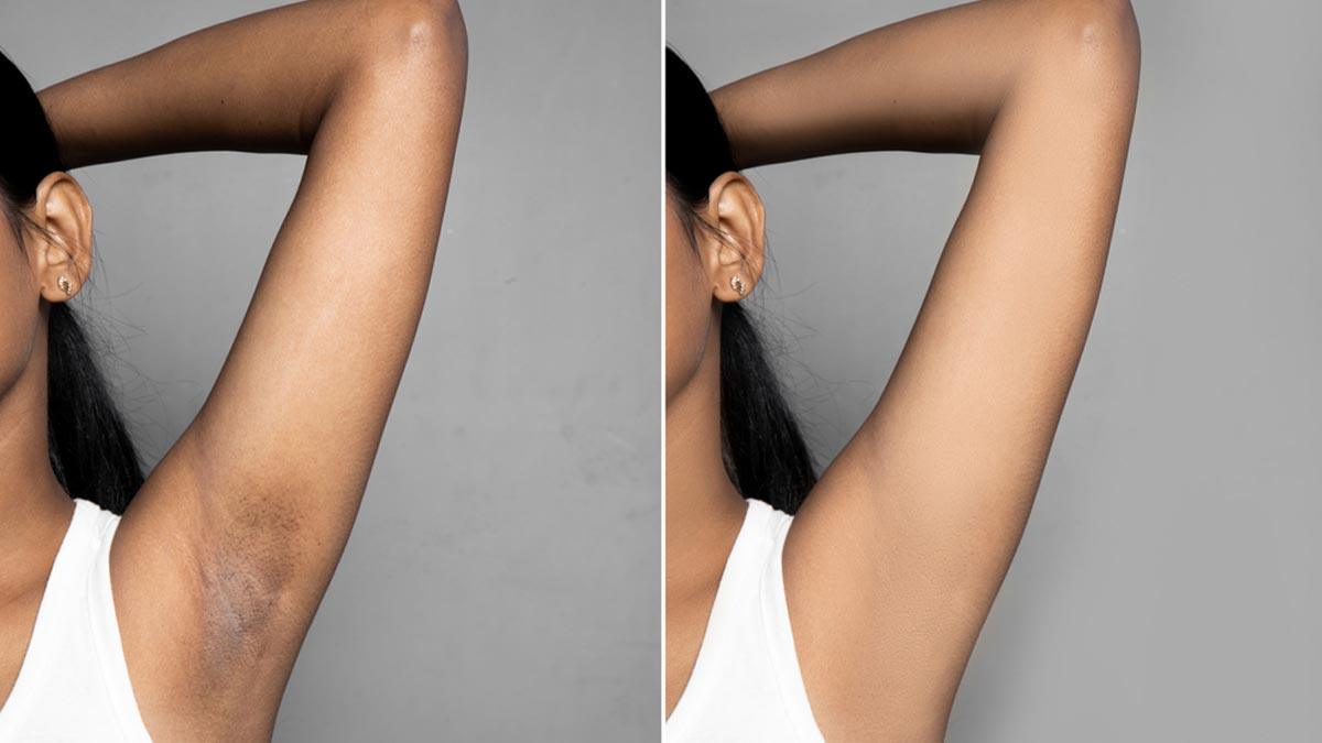 how to clean underarms fresh in hindi