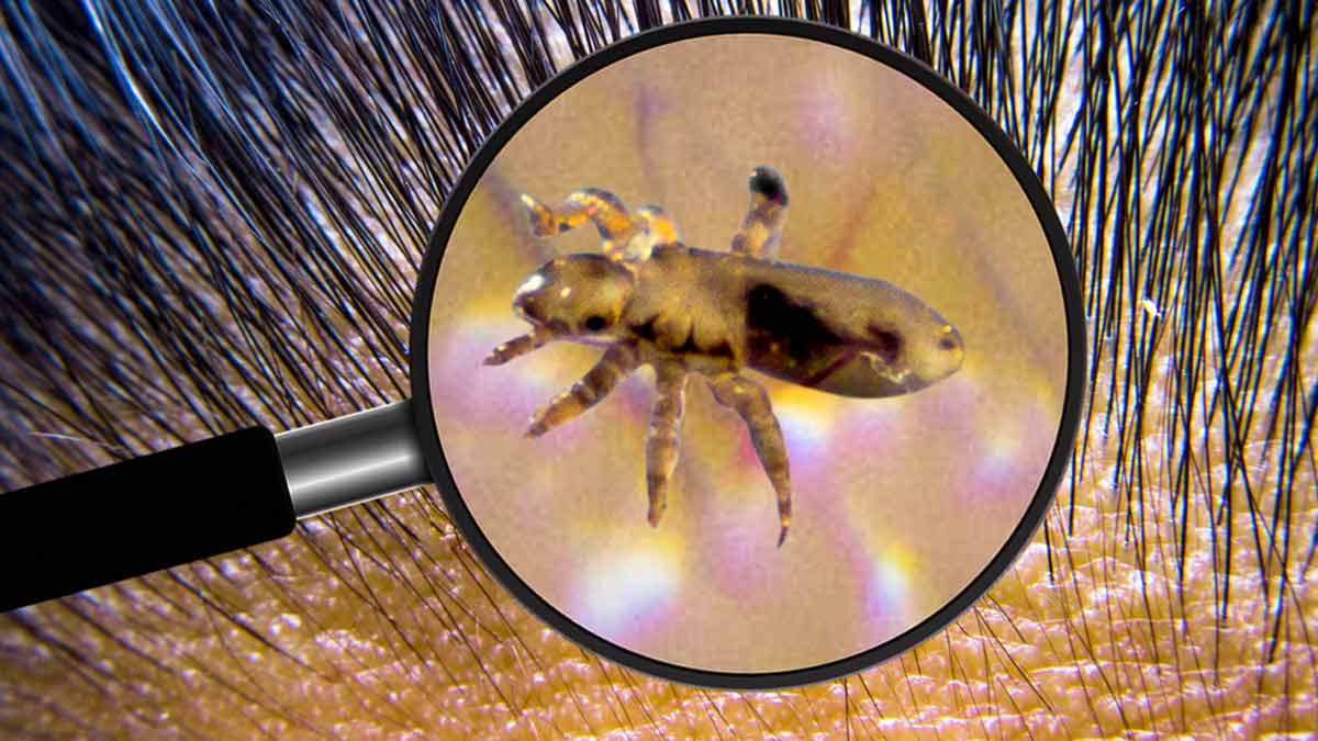how to get rid of head lice from pillows
