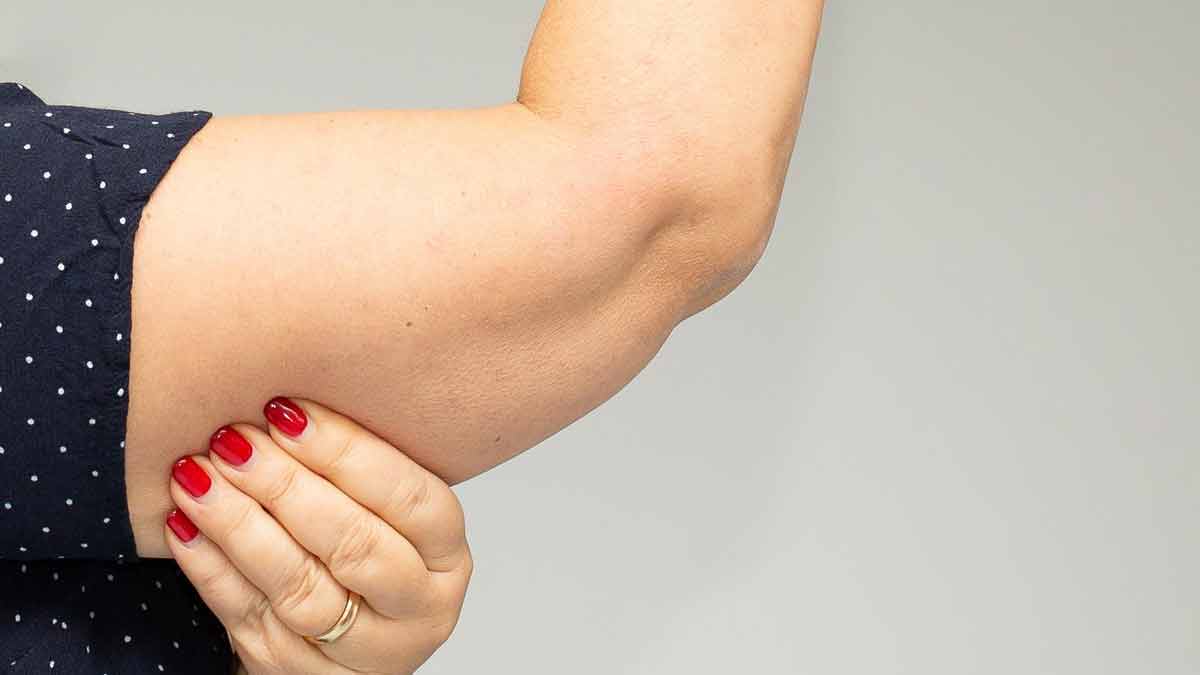 Slim Arms Fast How To Lose Arm Fat At Home How To Lose Arm Fat