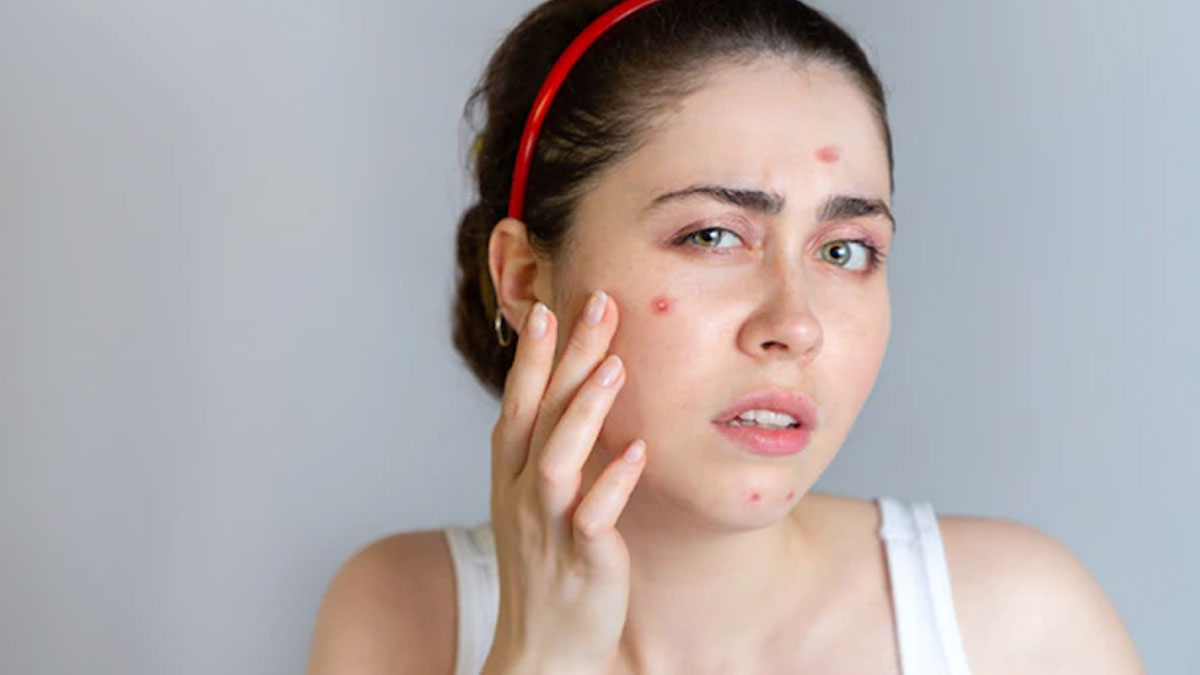 how to use banana for pimples in hindi