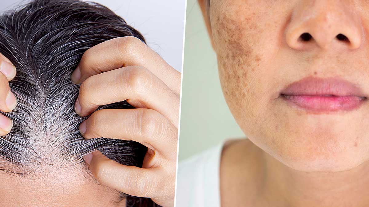 increase melanin in hair and skin hindi