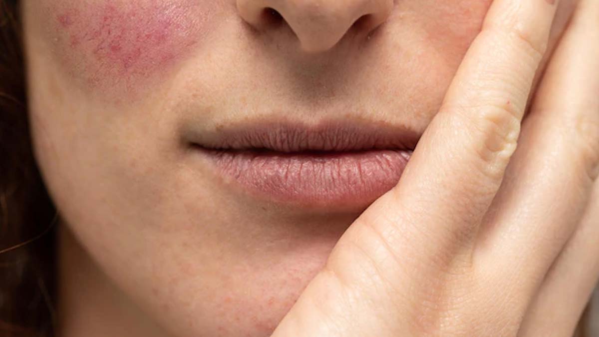 inflamed skin treatment