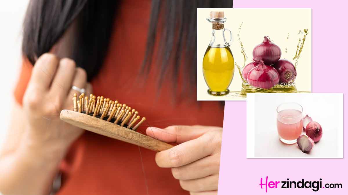 Onion for Hair| प्याज का रस बालों में कैसे लगाएं| Pyaz Baalo ke Liye | onion  juice vs onion oil for hair fall | HerZindagi