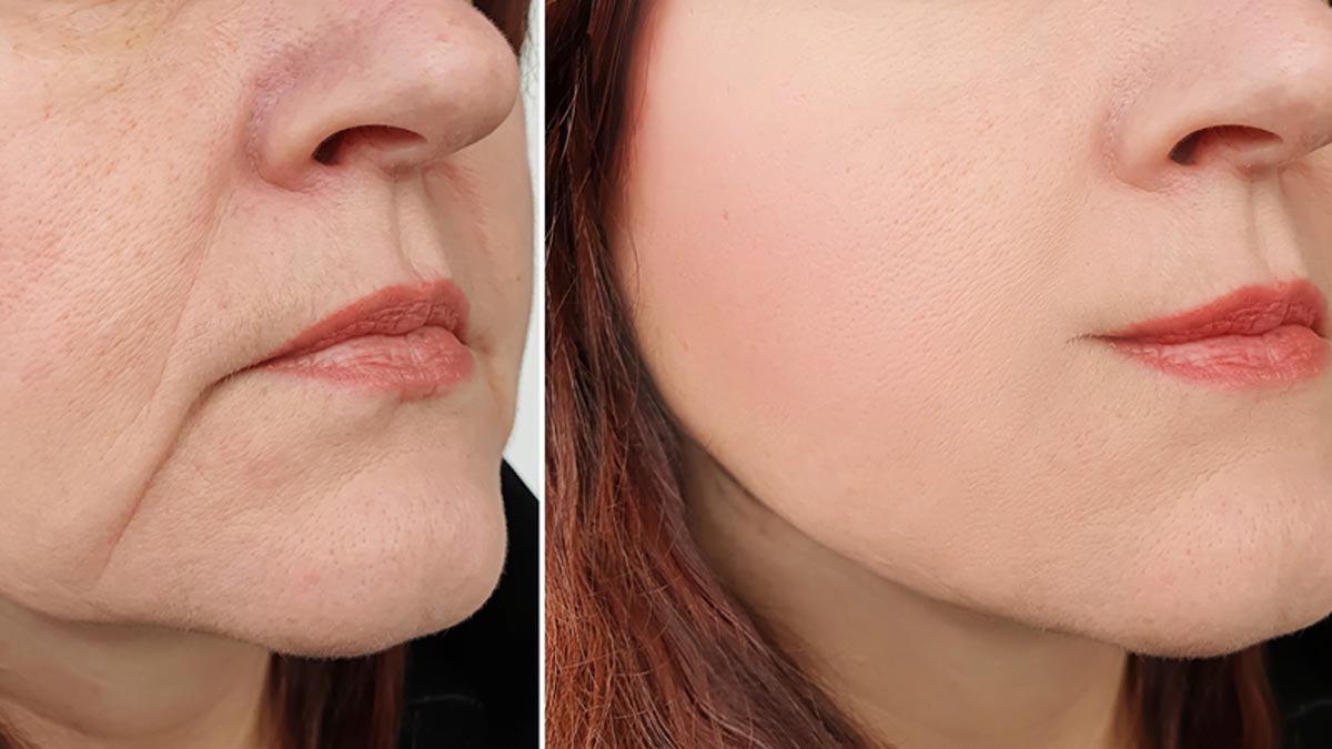 sagging skin care tips for  plus