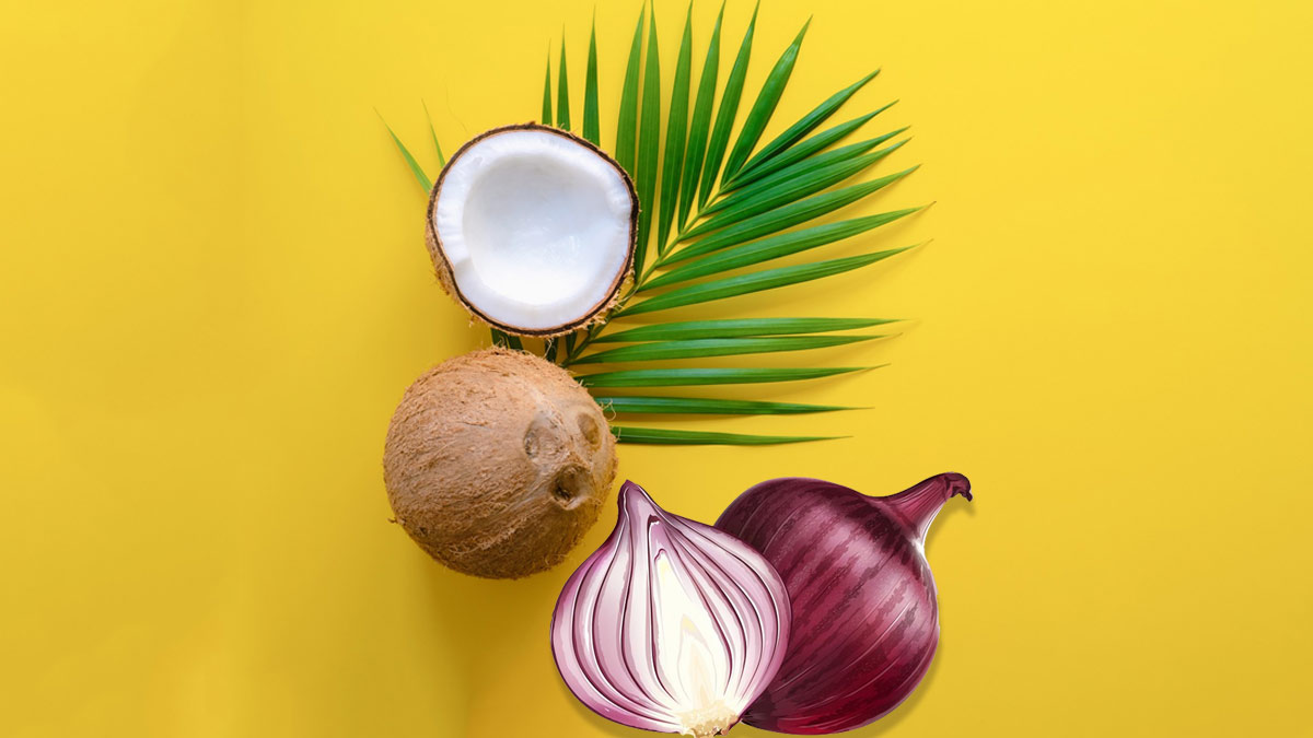 coconut-oil-onion-juice-dandruff-natural-ingredients-herzindagi