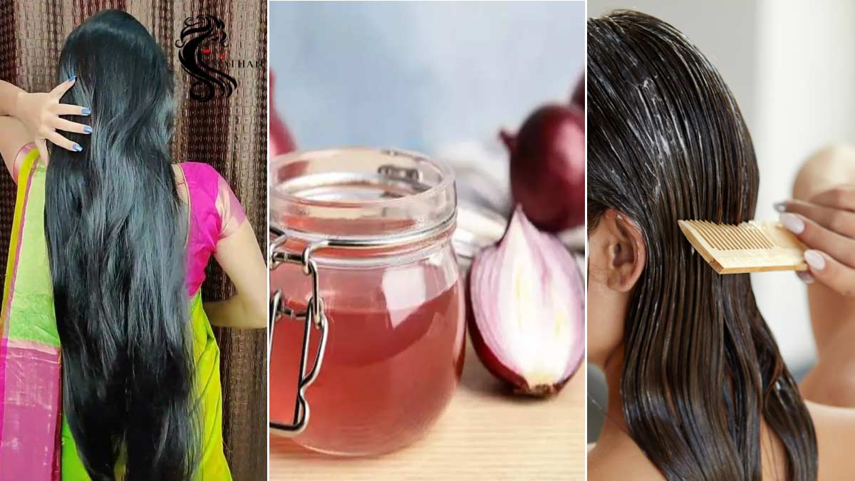 Expert Tips: Oily Hair Treatment | Hair Care कैसे करें | Balo Ki Care | how  to apply onion juice on oily hair | HerZindagi