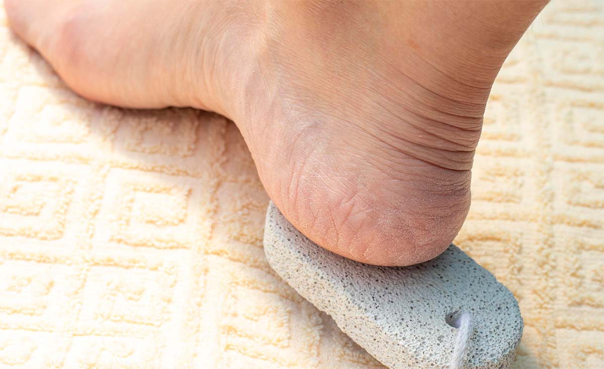 Pumice Stone प्यूमिक स्टोन के फायदे Pumice Stone Benefits For Skin