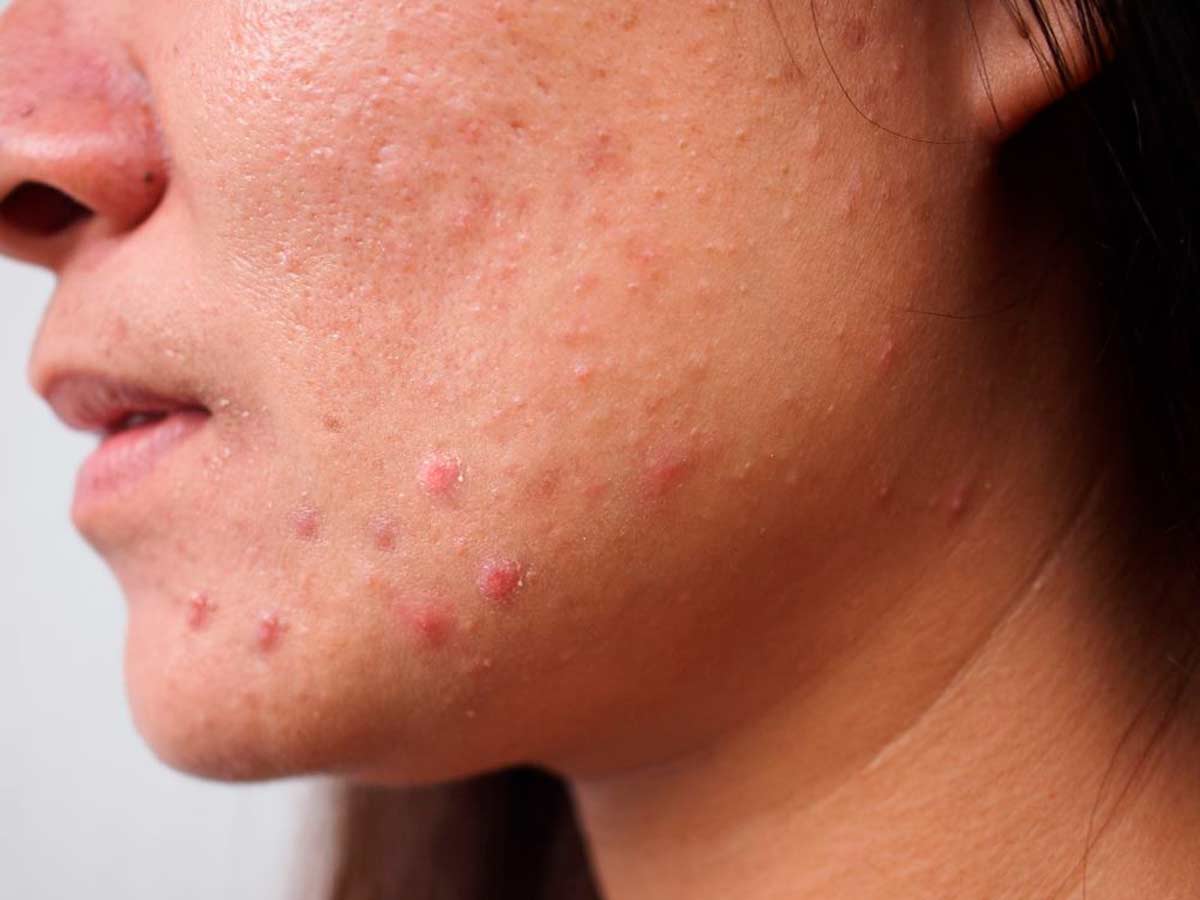 skin tone and its problems