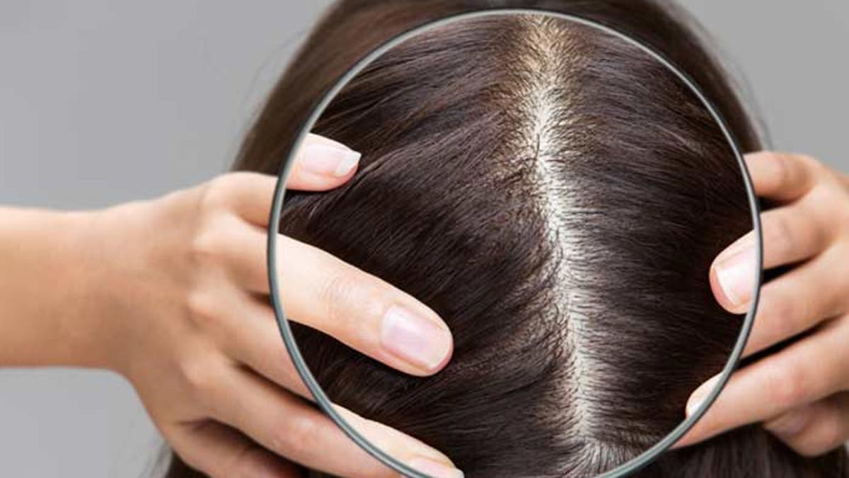 Hair Mask For Dry Hair ड्राई स्कैल्प के लिए हेयर मास्क Dry Hair Ke Liye Hair Mask Besan Hair