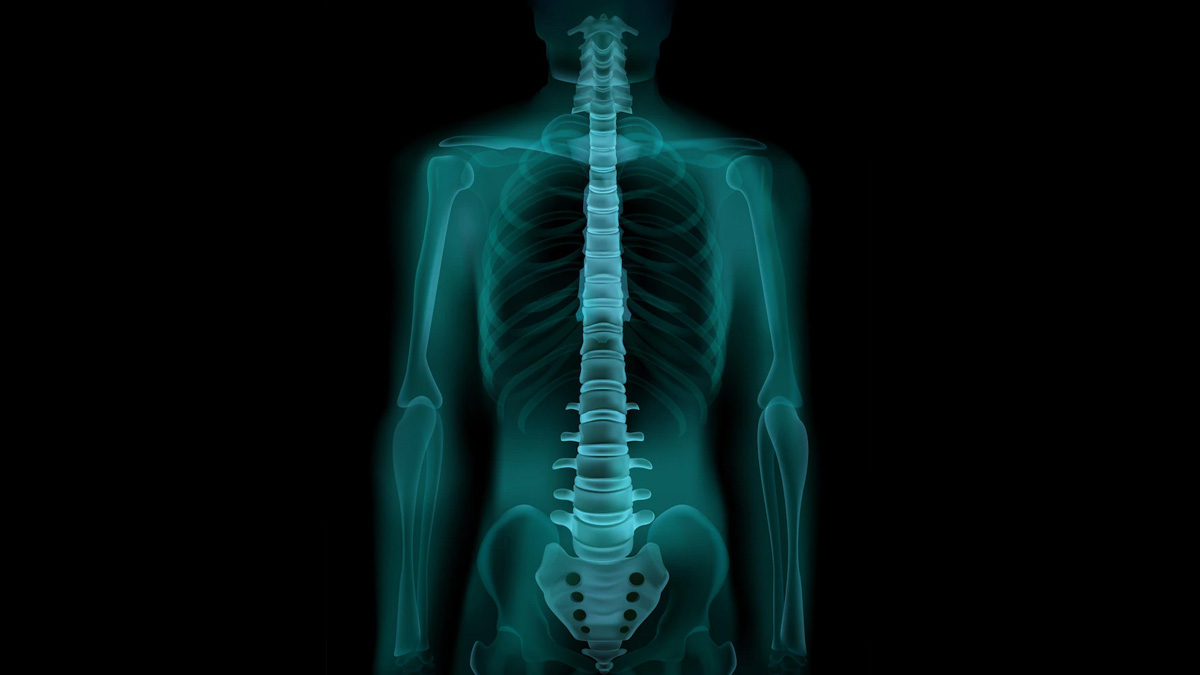 x ray made by mistakes