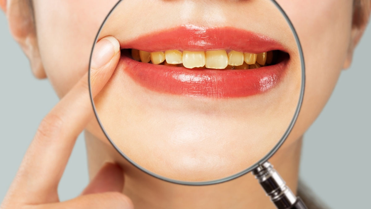 Tooth Powder For Whitening दांतों का पीलापन Ghar Par Dant Kaise Saaf Kare