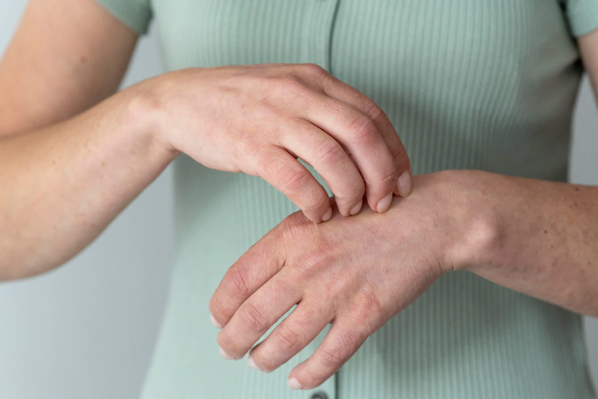 how to do patch test at home