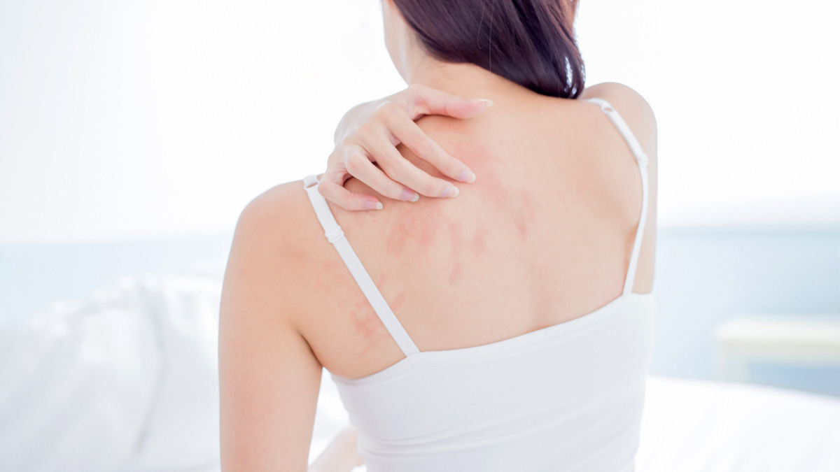 Dry Skin Treatment पीठ की ड्राईनेस कैसे करें दूर Desi Upay how to