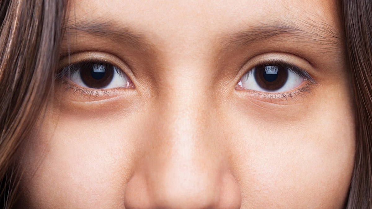 Badam Rogan Oil For Puffy Eyes