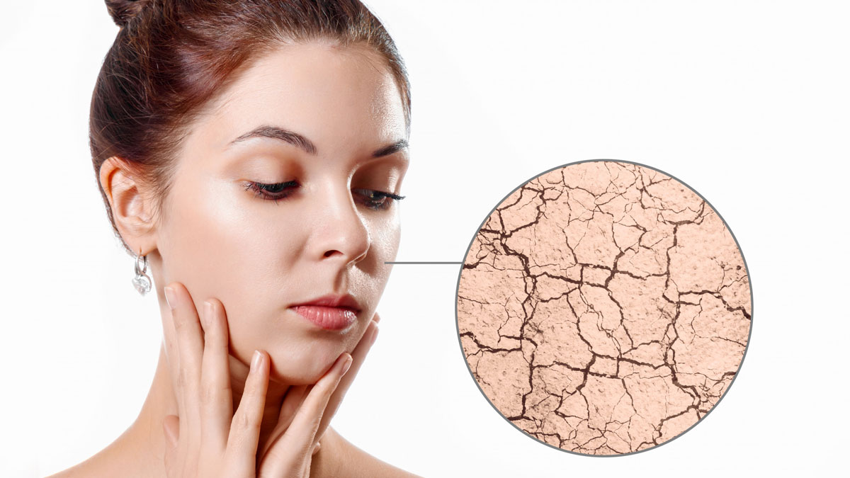 dry skin