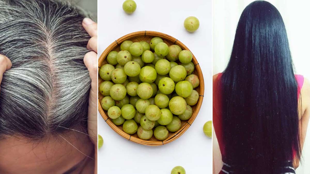 White Hair| सफेद बालों को काला करने का तेल| White Balo Ka Ilaj In Hindi | white  hair home remedy | HerZindagi