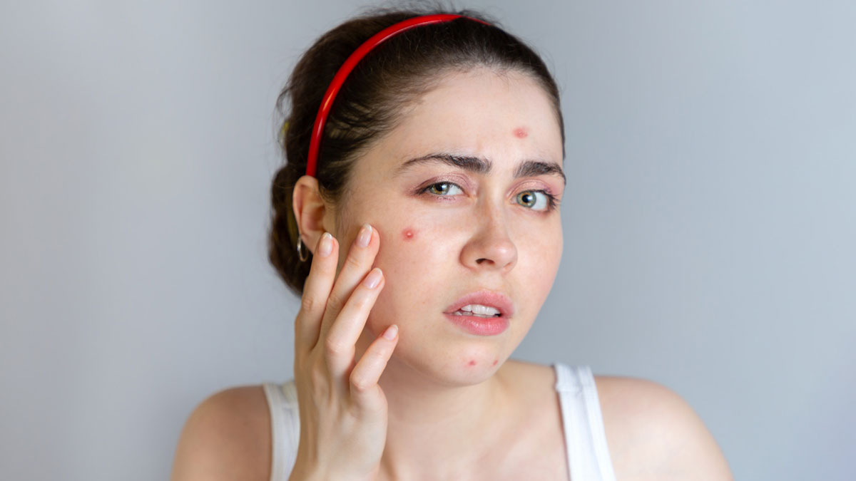 how to combat pimple