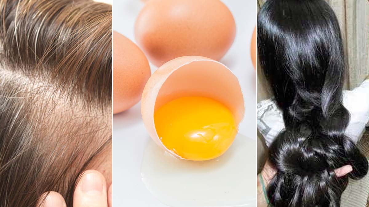 How To Use Egg On Hair| बालों में अंडा लगाने के फायदे| Egg Benefits Balon  Ke Liye | how to use egg for hair thickness | HerZindagi