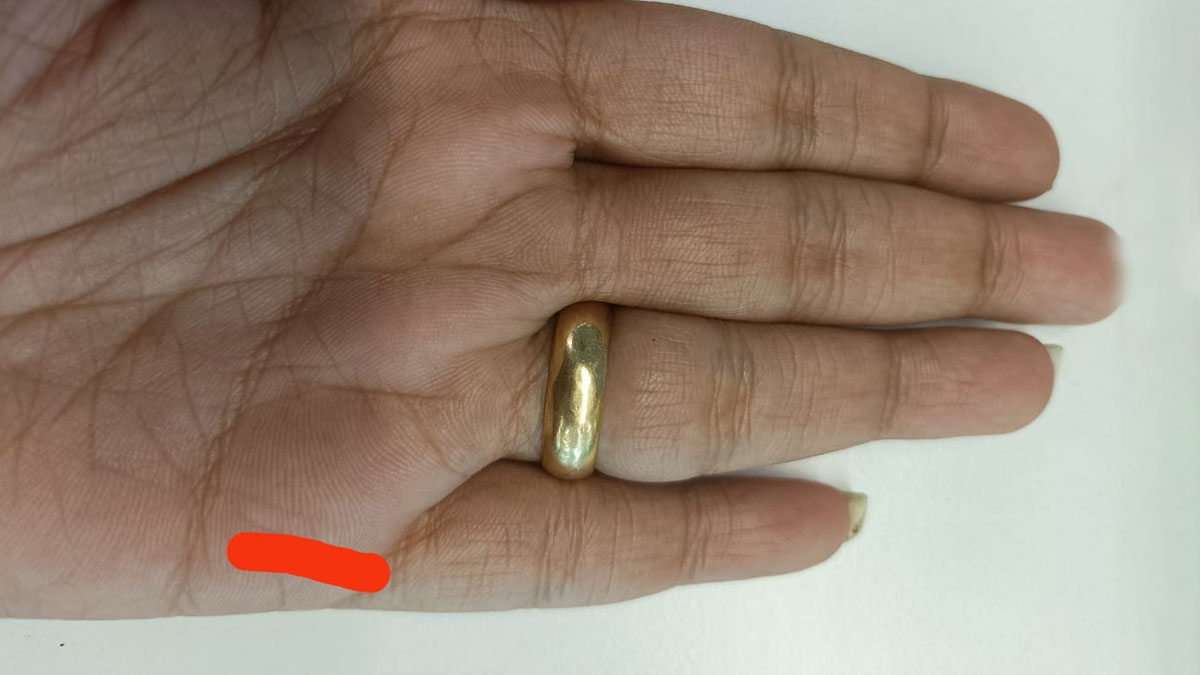 little finger of your hand