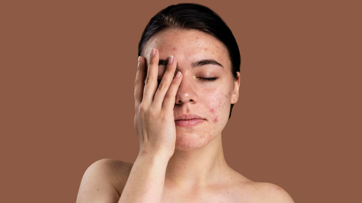 skin concern and treatment by expert