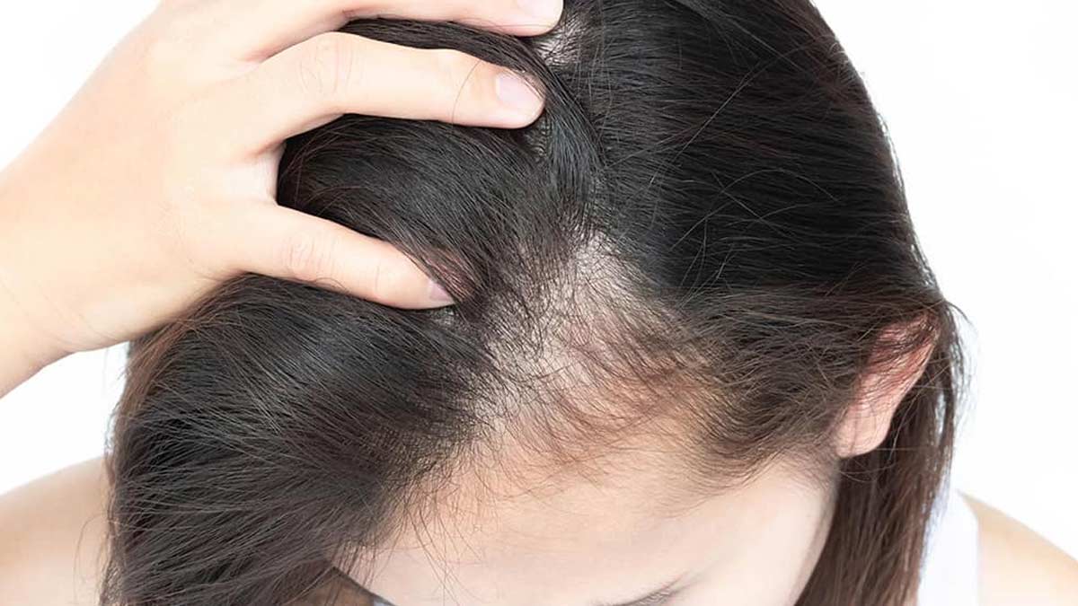 tips to hiding thinning hair in front