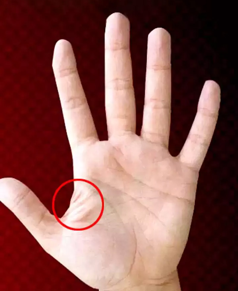 bad marks on palm