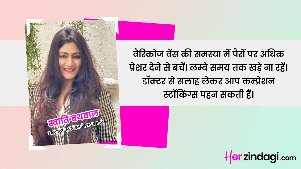 expert advice on varicose veins