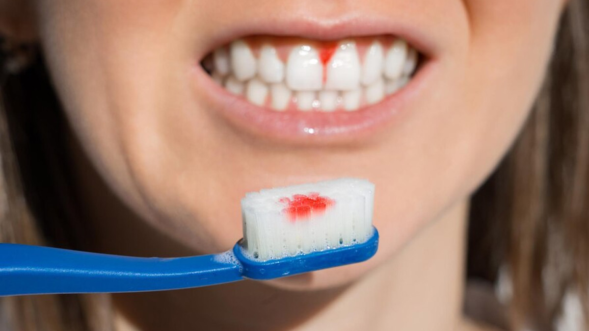 is sugar bad for your teeth if you brush them
