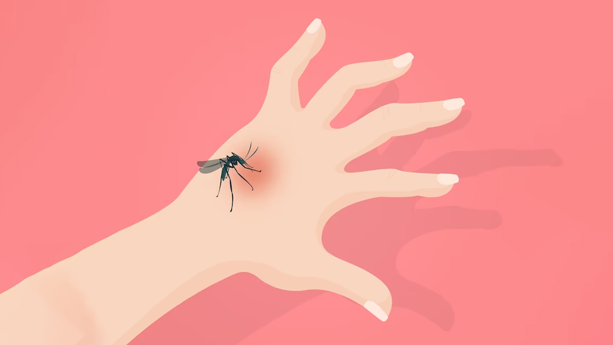 world-malaria-day-not-just-a-mosquito-bite-if-symptoms-include-fever