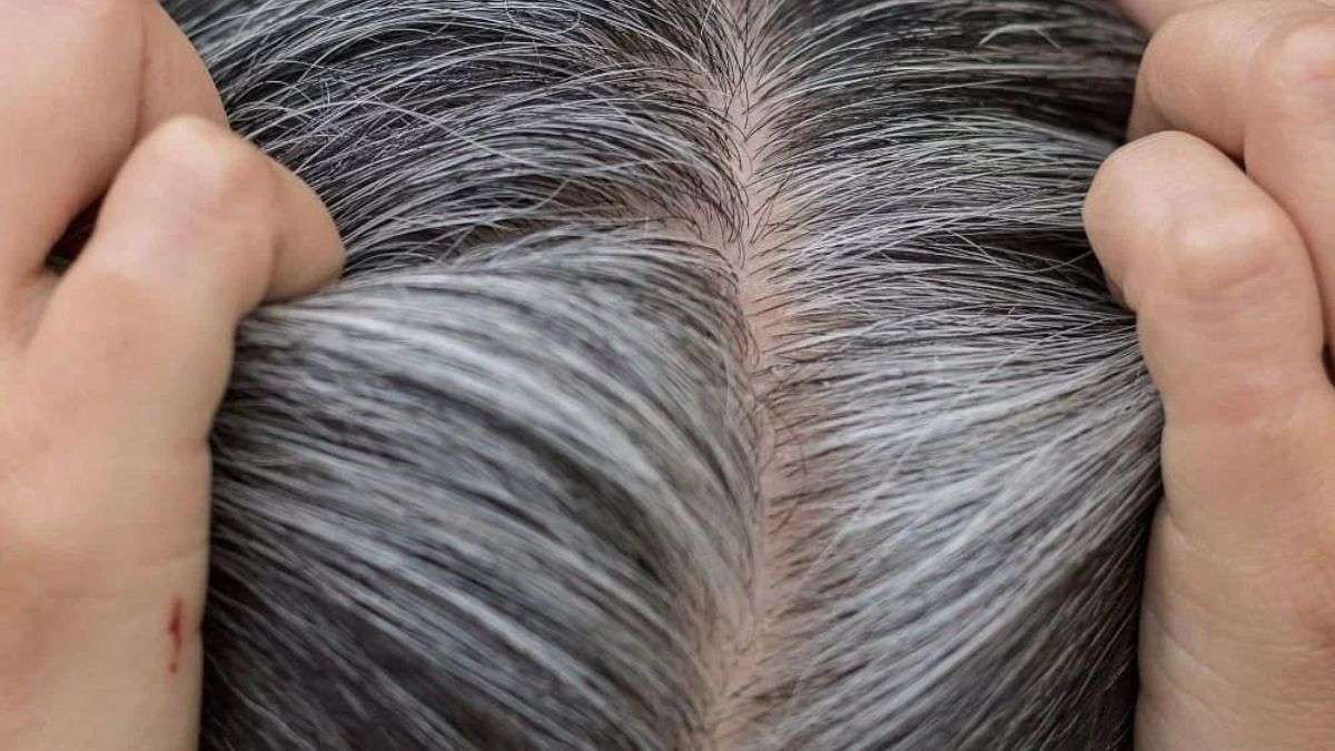 White Hair Tips : இளமையில் முடி நரைப்பதை நிறுத்த முடியுமா?