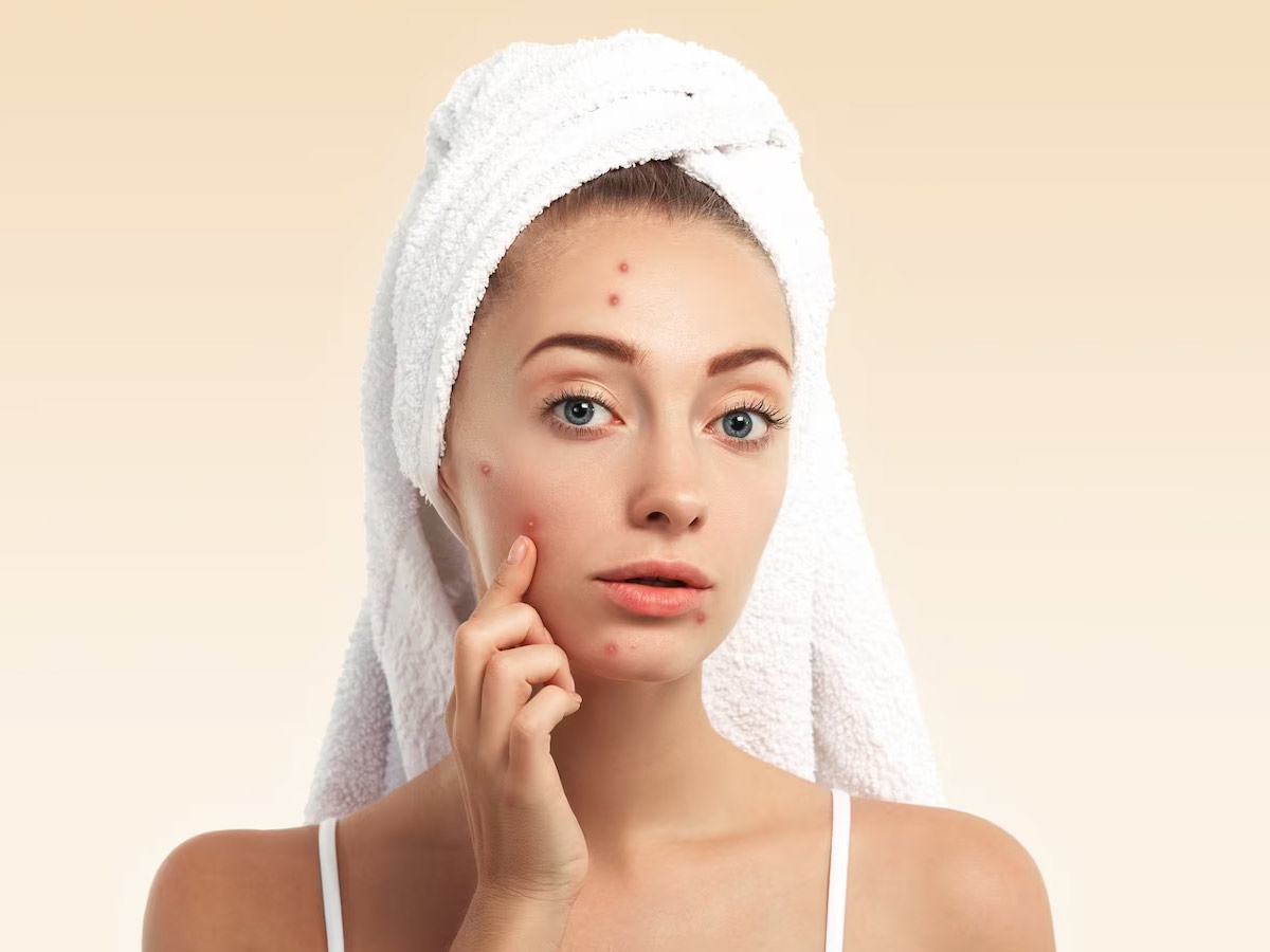 how to use besan for acne