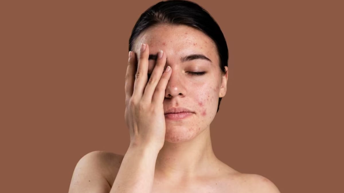 stomach problem  skin care 