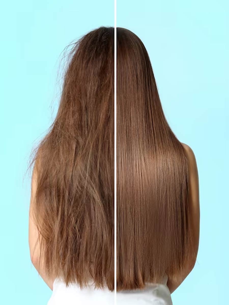 hair thining problems and its symptoms