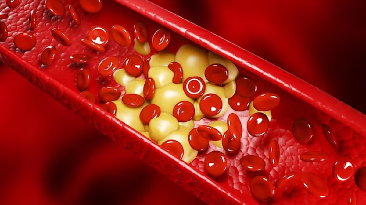 इन फूड्स के सेवन से हो जाएगा बैड कोलेस्ट्रॉल का सफाया | foods that support  healthy cholesterol | HerZindagi