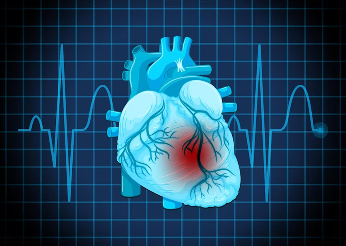 ffr-measurement-for-heart-attack-clinical-trial-2024-power