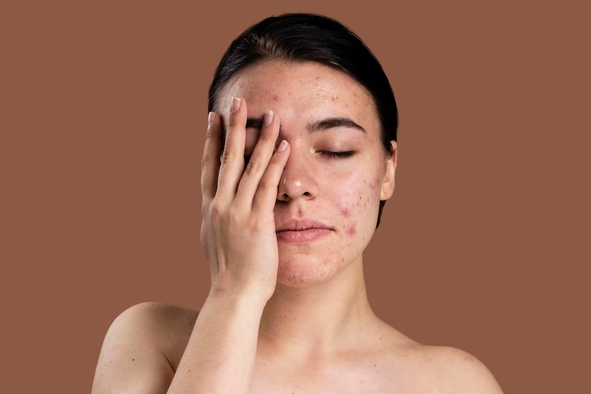 oily skin care tips ()