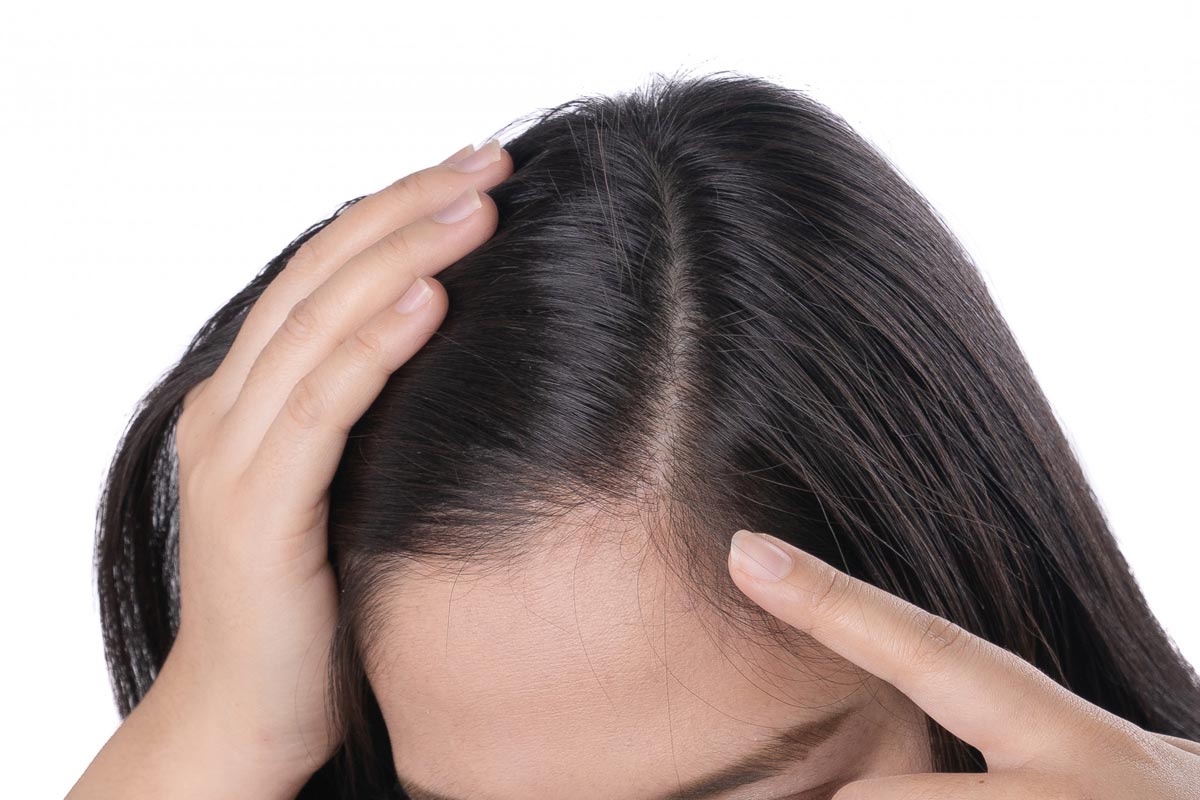 பெண்கள் தலைமுடி உதிர காரணம், Causes of Hair Fall in Women | hair fall  reasons in tamil | HerZindagi Tamil