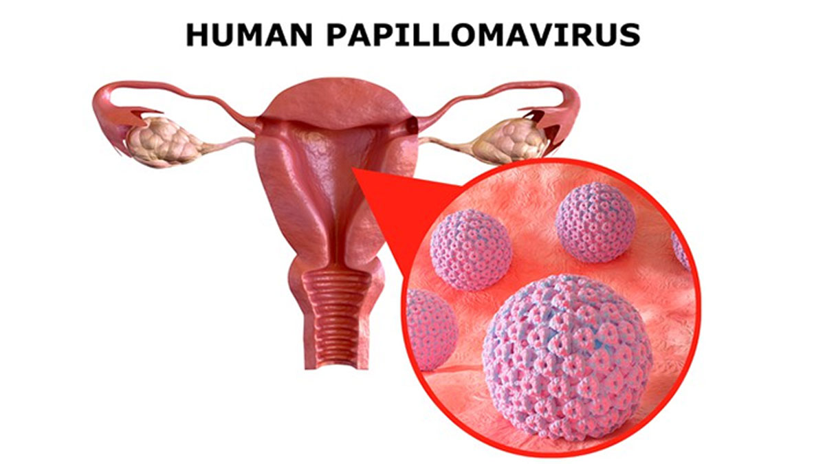 cancer and hpv