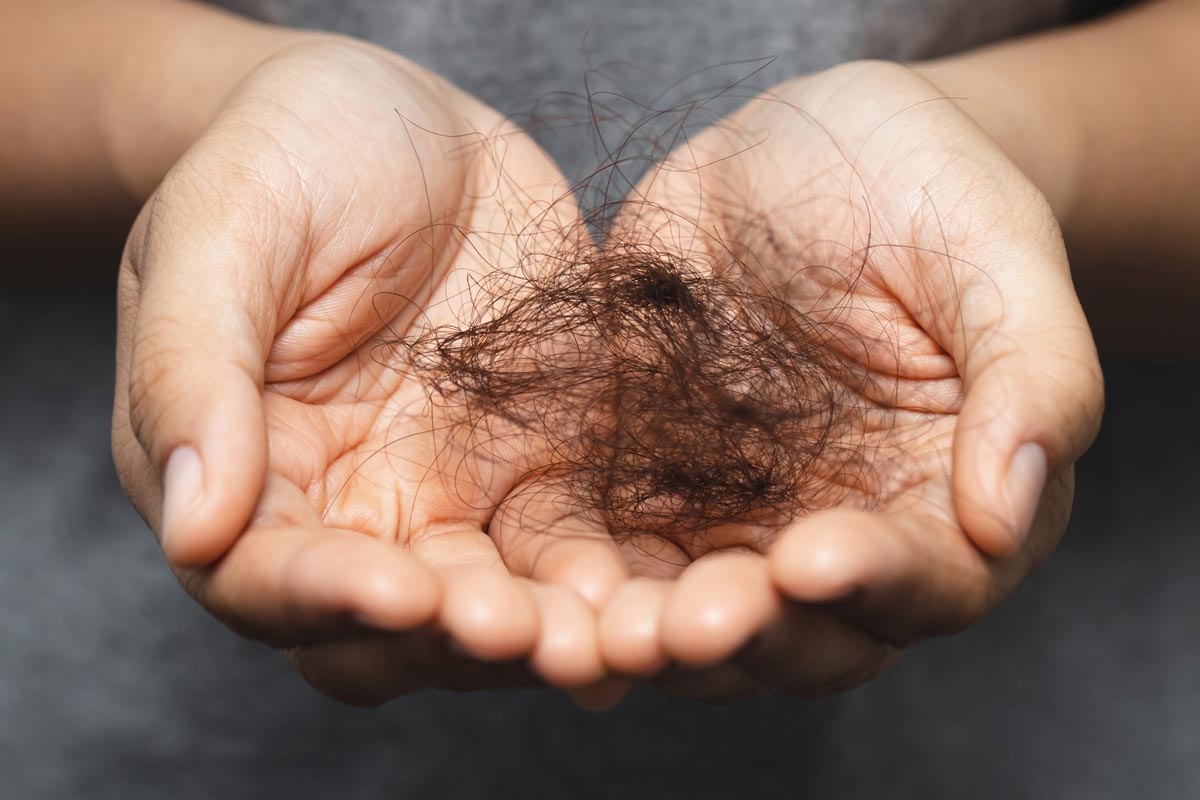 Hair Loss Specialist | Beverly Hills Hair Restoration