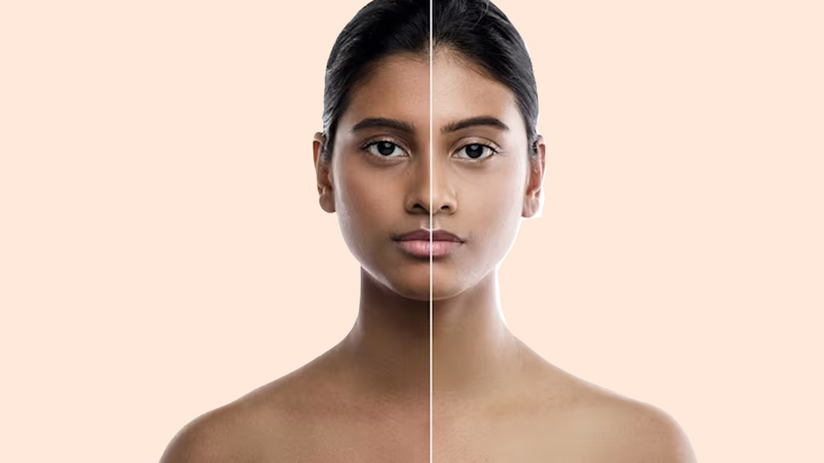 Dull Skin Tips : சருமத்தை பொலிவாக்க இதை செய்தாலே போதும்