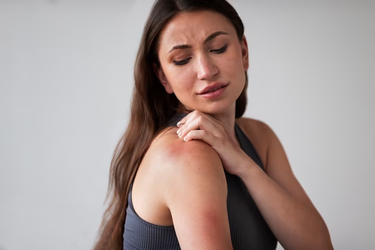 home-remedies-for-skin-rashes