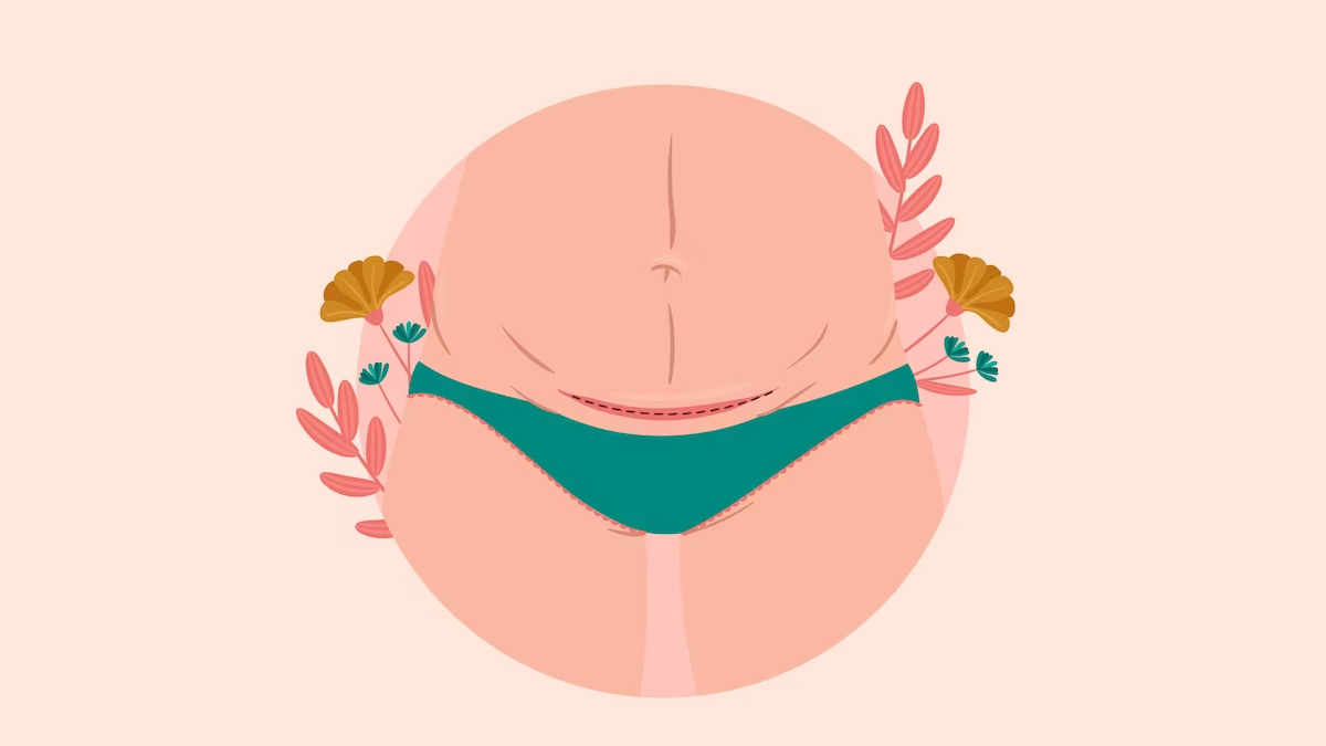 doctors get more c section