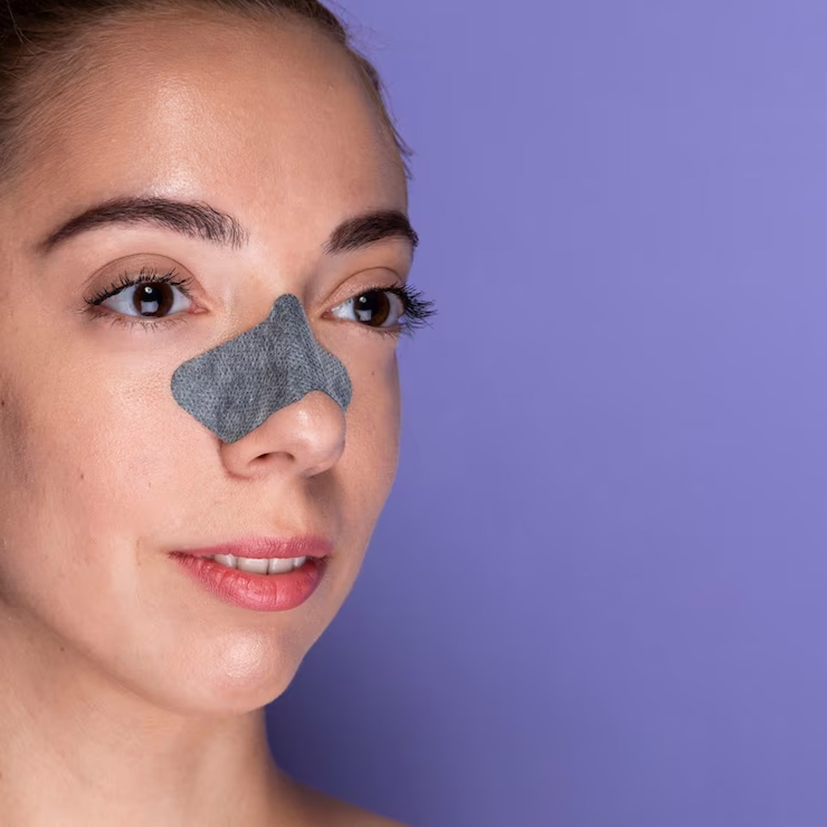 remedy for blackheads