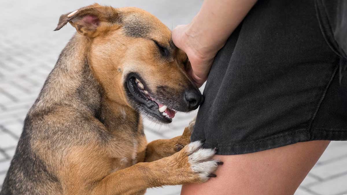 First Aid for Dog Bite : நாய் கடித்தால் செய்ய வேண்டிய முதலுதவிகள் என்ன தெரியுமா? 